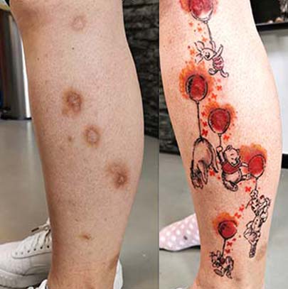 Narbenabdeckung Tattoo Stilrichtung